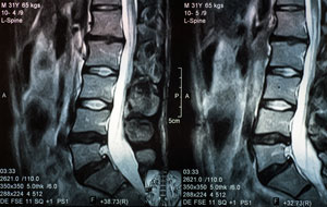spine-conditions